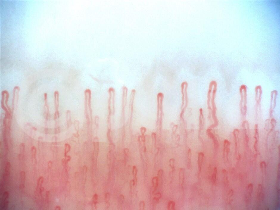 Capillaroscope BASIC tekninen kuva1