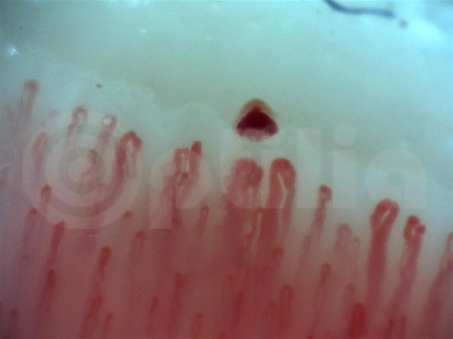 Capillaroscope BASIC tekninen kuva2