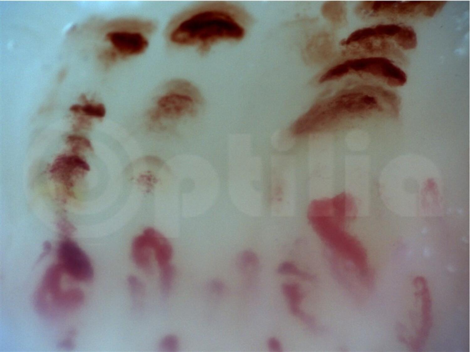 Capillaroscope BASIC tekninen kuva3