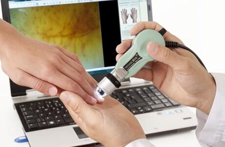 Capillaroscope BASIC2