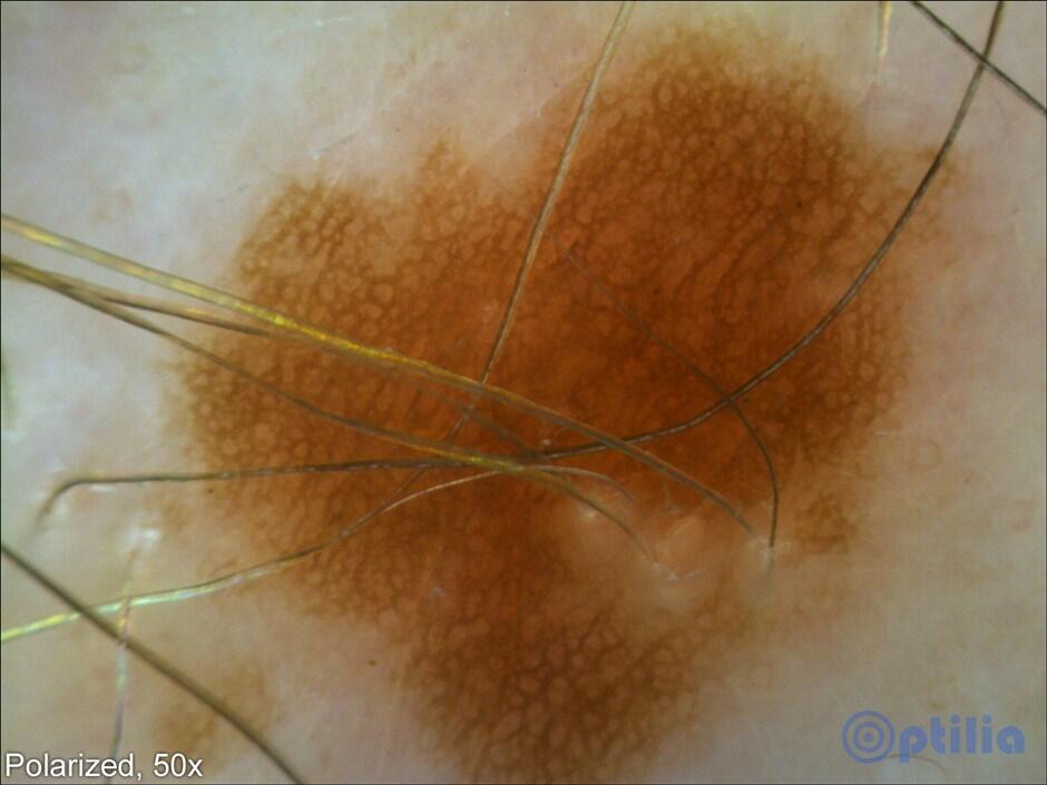 Dermatoscope BASIC tekninen kuva1