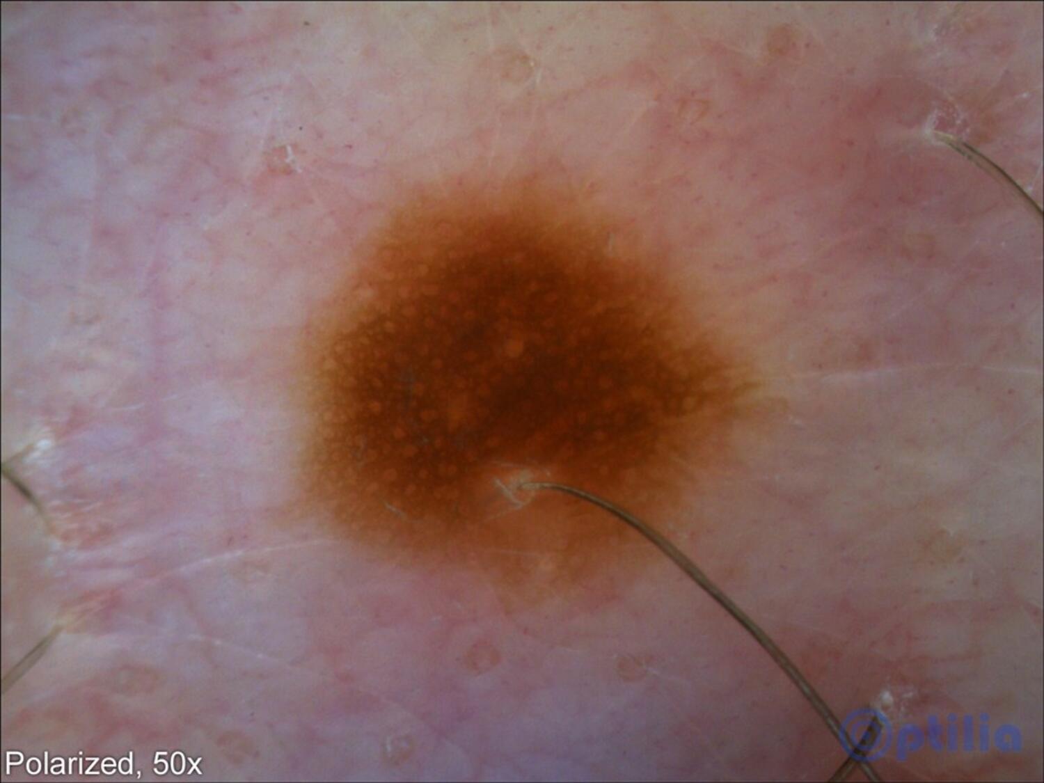 Dermatoscope BASIC tekninen kuva2