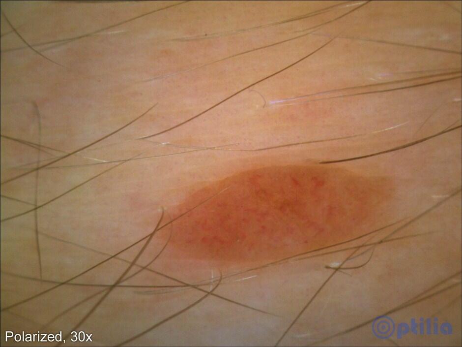 Dermatoscope BASIC tekninen kuva3