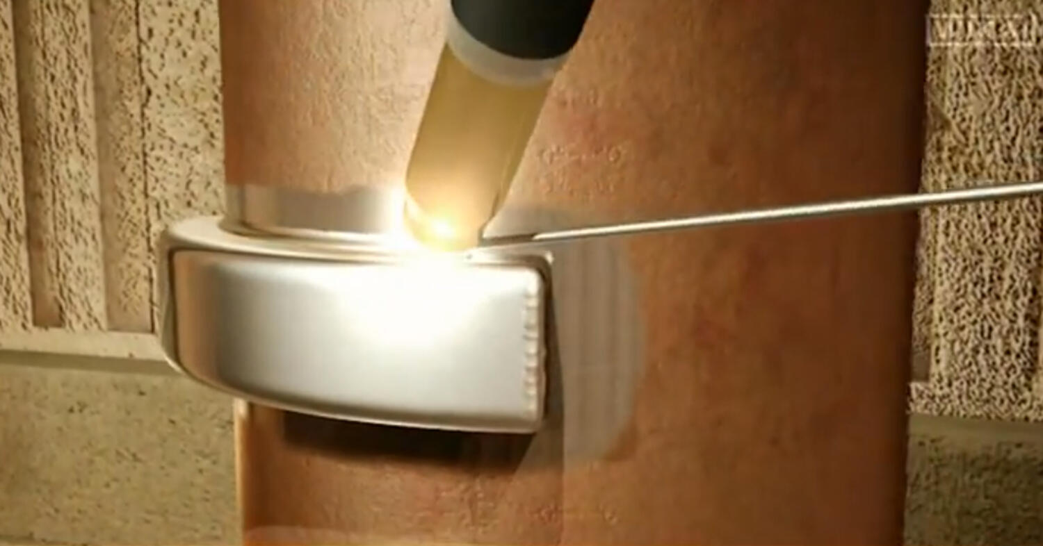 Putkipintalämpötilatermoelementin kokoonpano REFRACTO-PAD